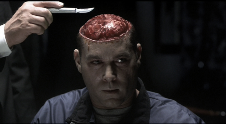而在1950年代的著名案例中,吃别人的脑的人导致自己脑袋退化如海绵,是