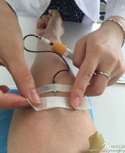 妞快报:伊能静打针抽血准备怀孕 「想让秦先生知道胎动的感动」